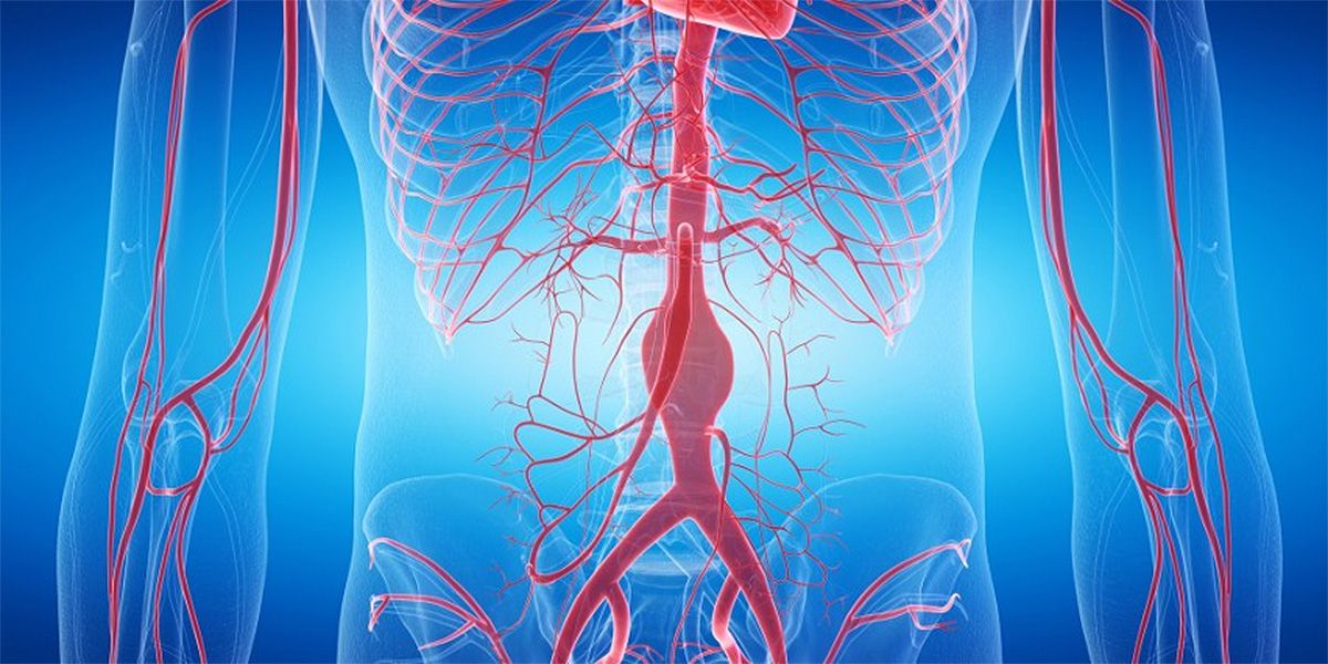 Abdominal aortic aneurysm