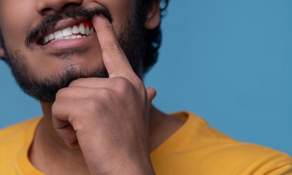 Adult man showing his gums