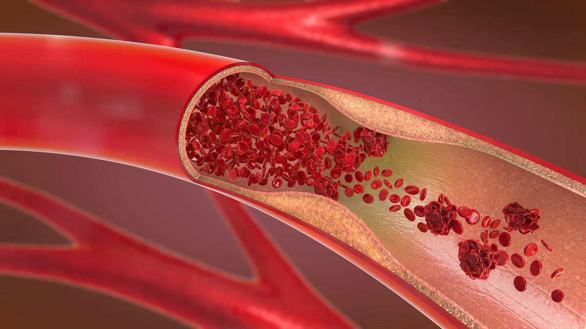 Cross section of an artery