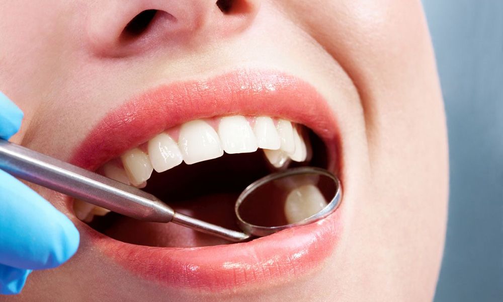 Dentist looking for cavities in a womans teeth