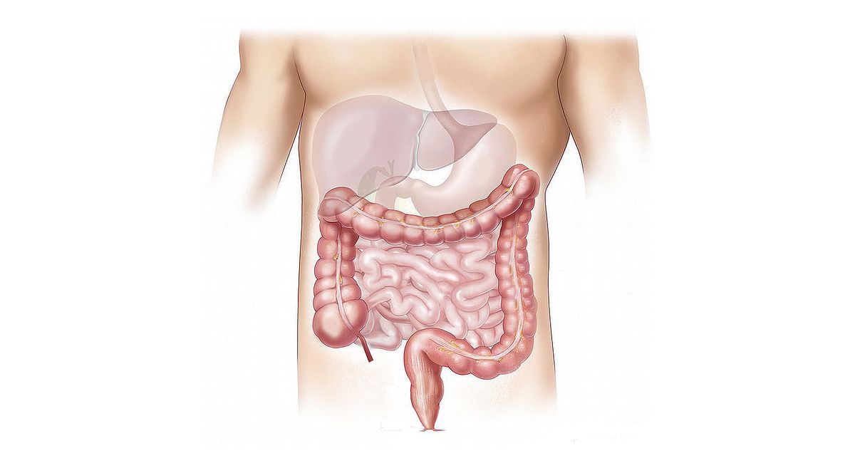 Intestines