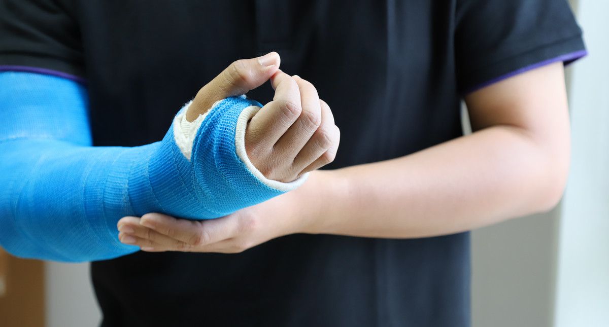 Man with a cast on his arm